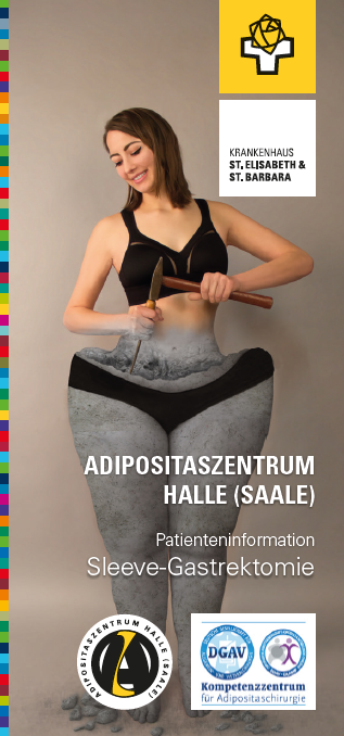 Sleeve Gastrektomie